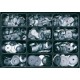 Coffret E-NORM 12 K-Scheibe zn